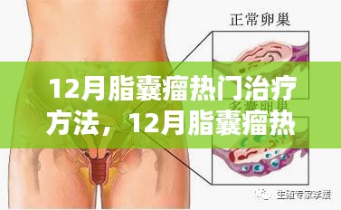 12月脂囊瘤热门治疗方法深度解析与评测