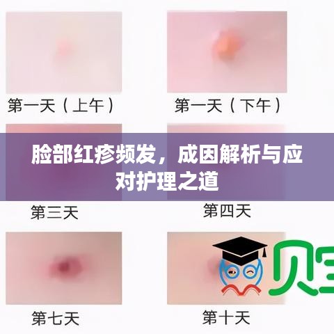 脸部红疹频发，成因解析与应对护理之道