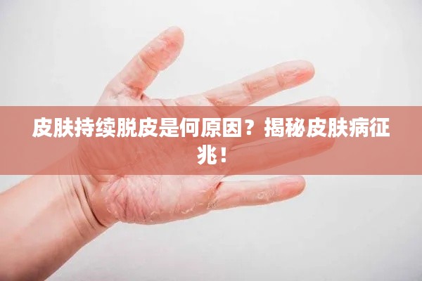 皮肤持续脱皮是何原因？揭秘皮肤病征兆！